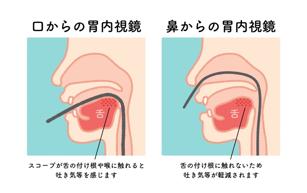 2種類のカメラ